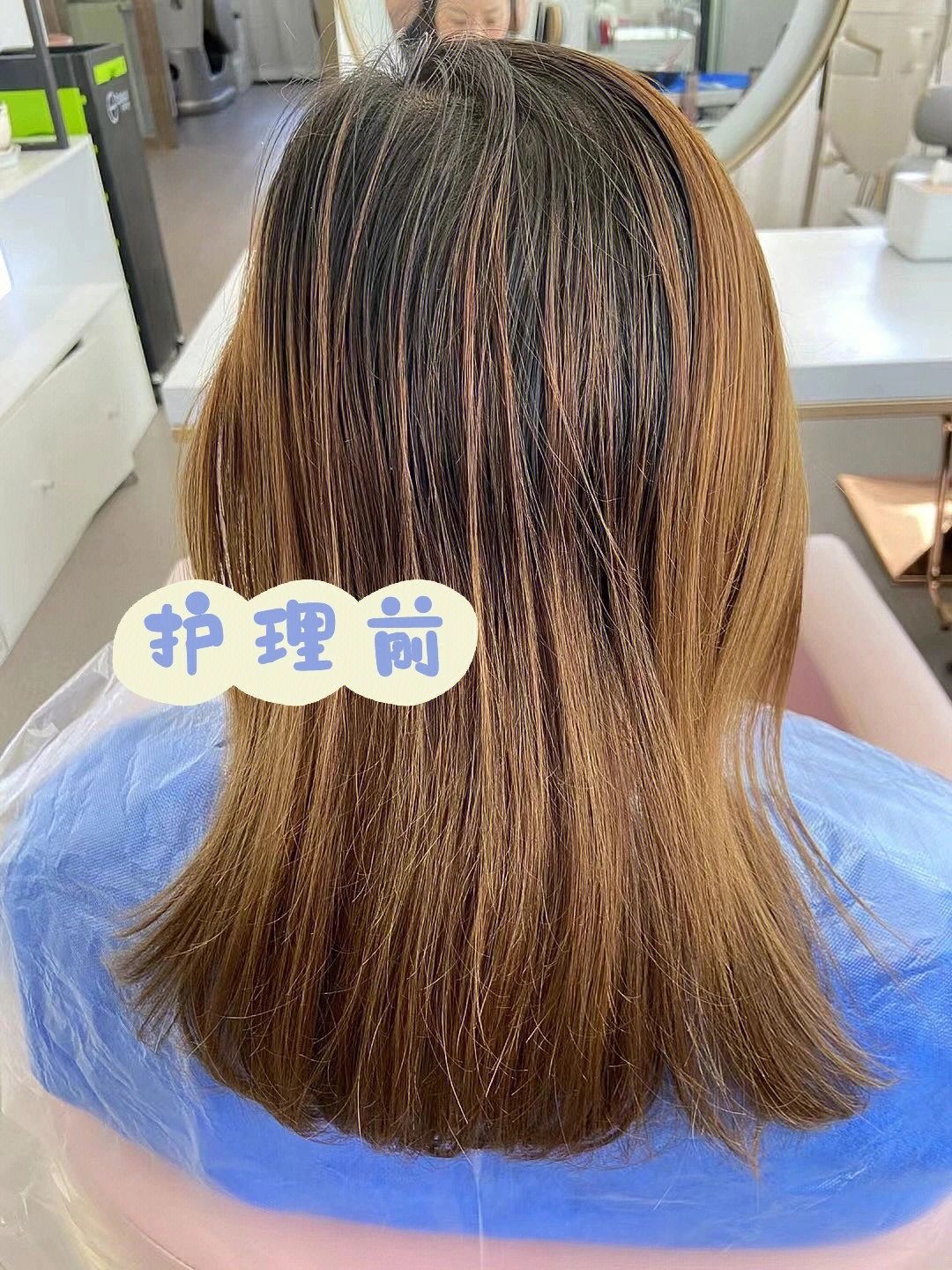 头皮护理不勤，头顶发量不稳 当你想要善待 配图1