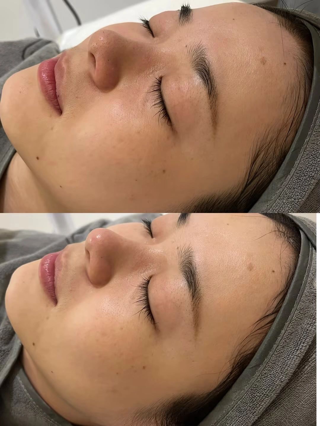 清洁补水前后 透亮度好绝