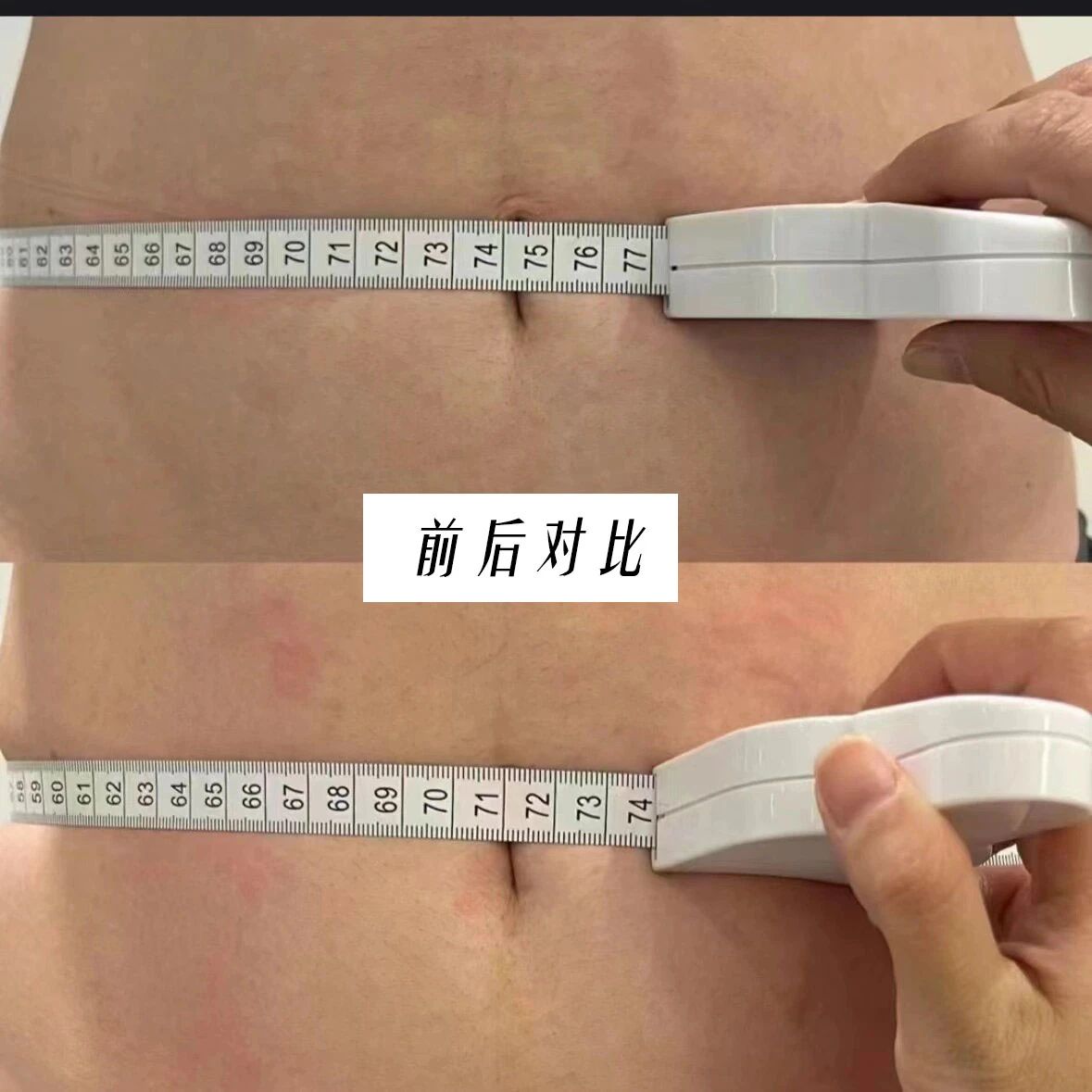🌟有效的产后修复 一定是先修复、再塑型 
