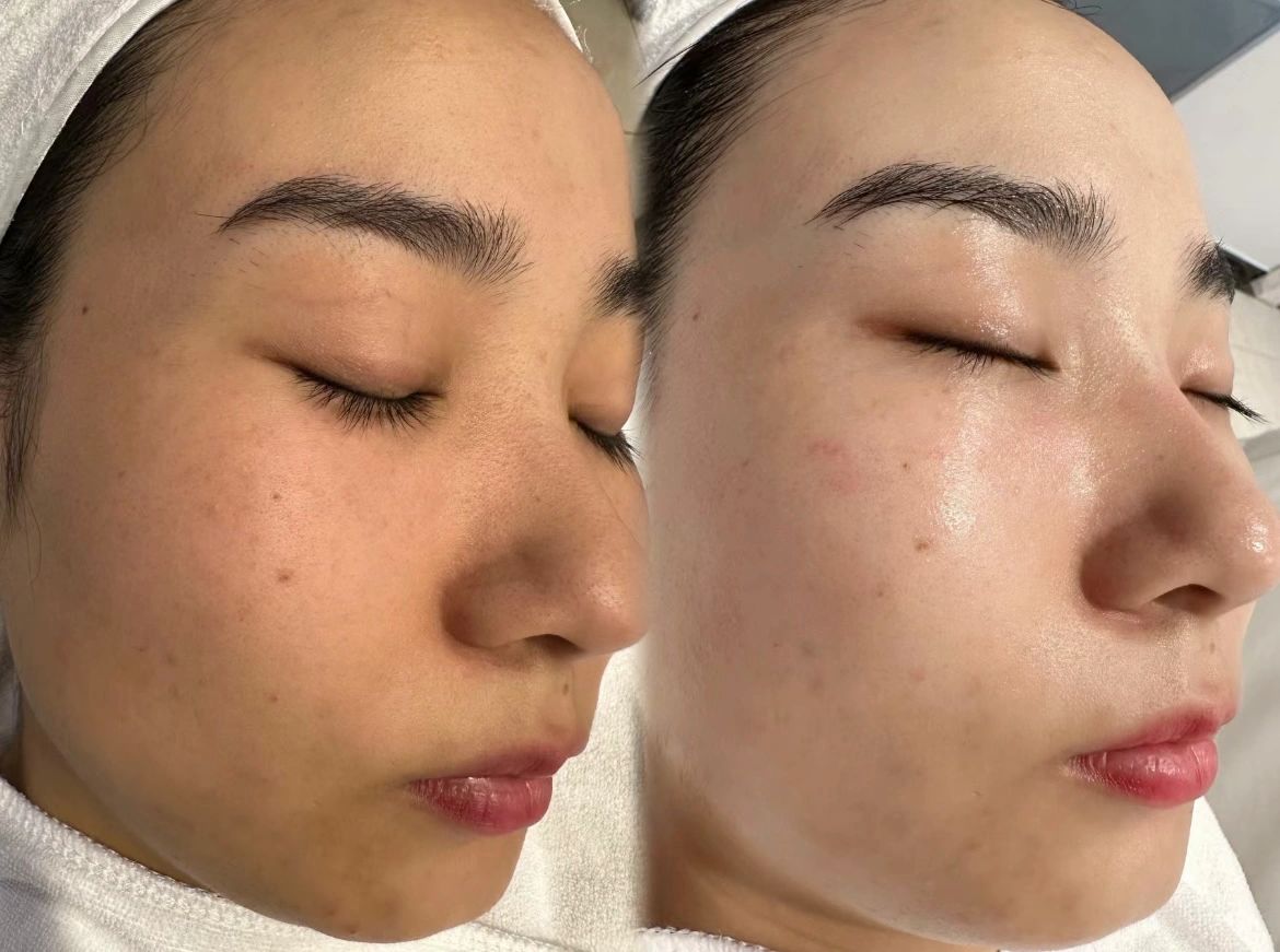 小姐姐对皮肤管理的效果 要求就是一个字“