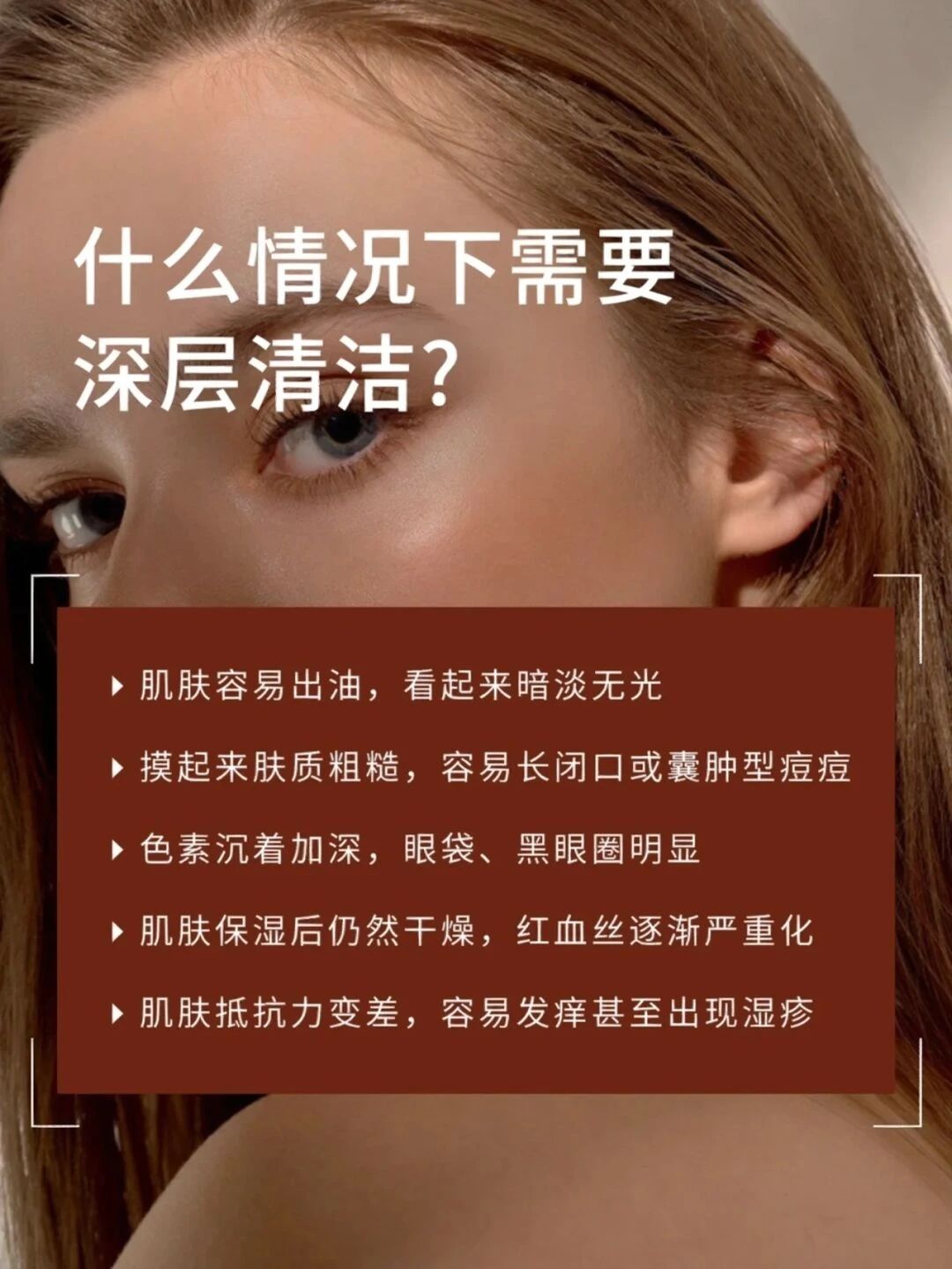 什么情况下需要深层清洁? ☞肌肤容易出油