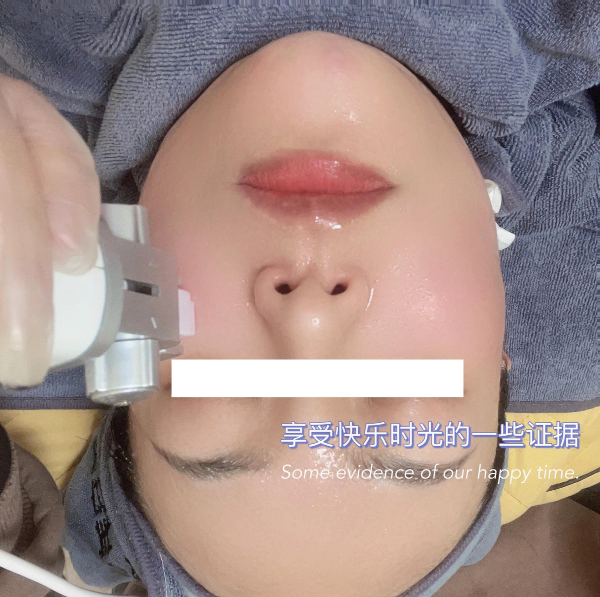 免麻无创无痛💉 正适合害怕针剂的我 水光