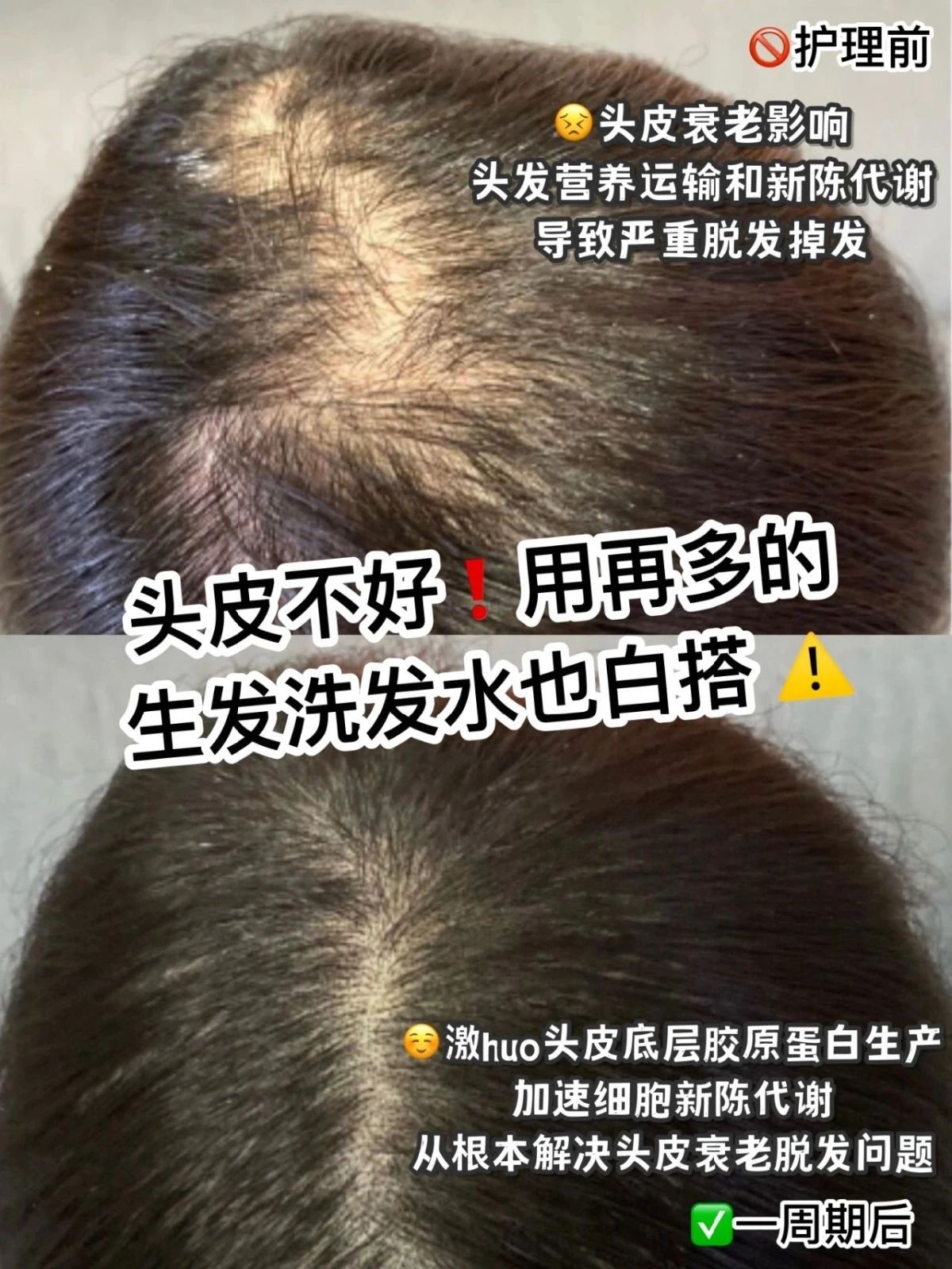 脱发、斑秃...... 颜值不在线？ 头