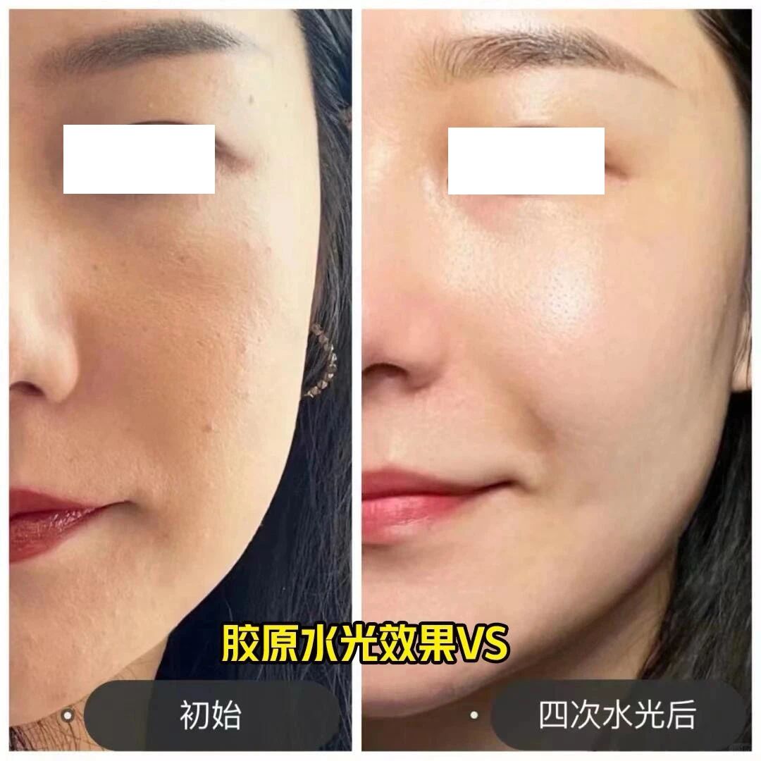 分享一下我的水光肌 从暗沉到亮白，光滑细