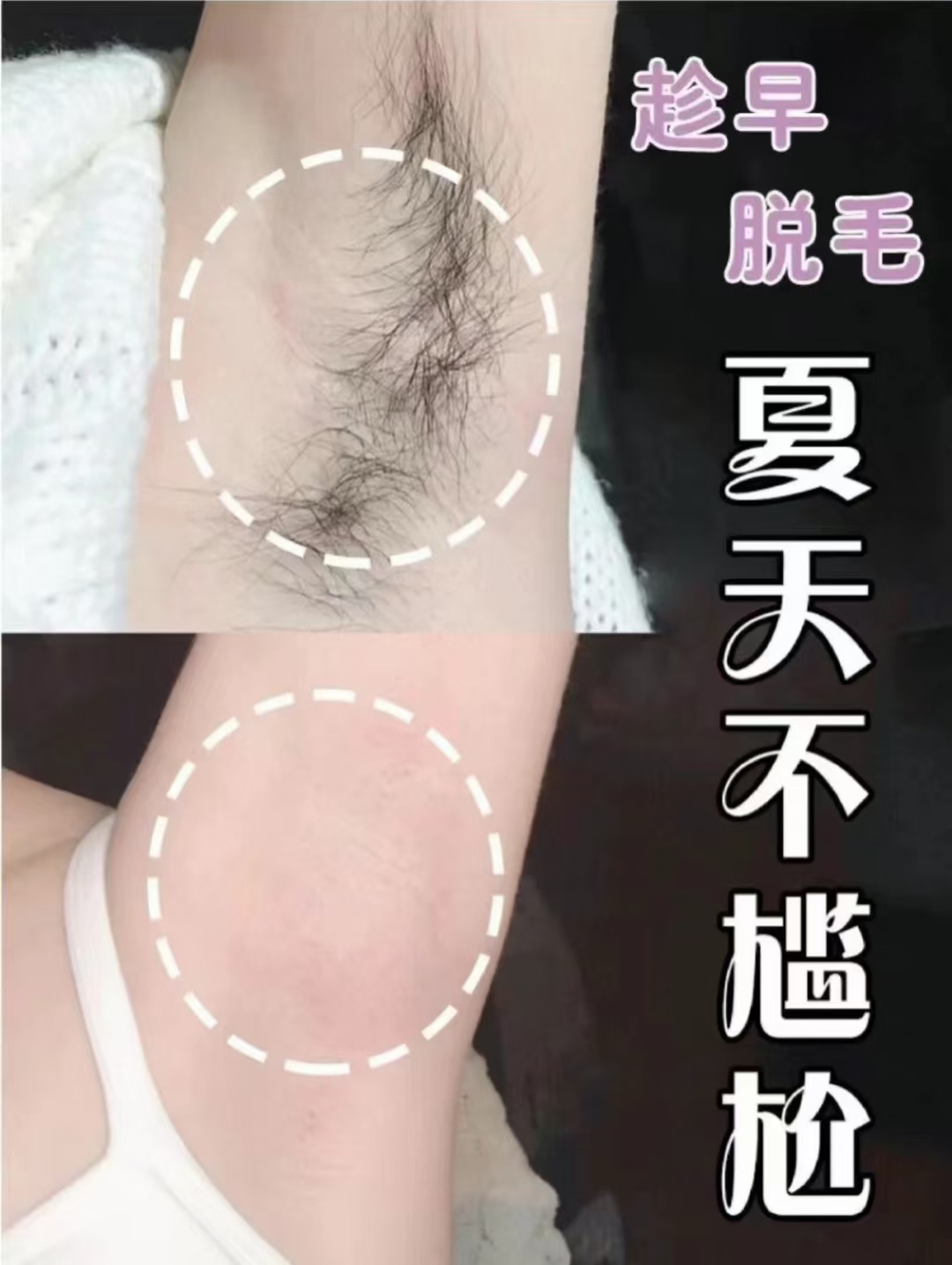 你该脱毛了‼️ 为夏天的裙子 短袖 吊带