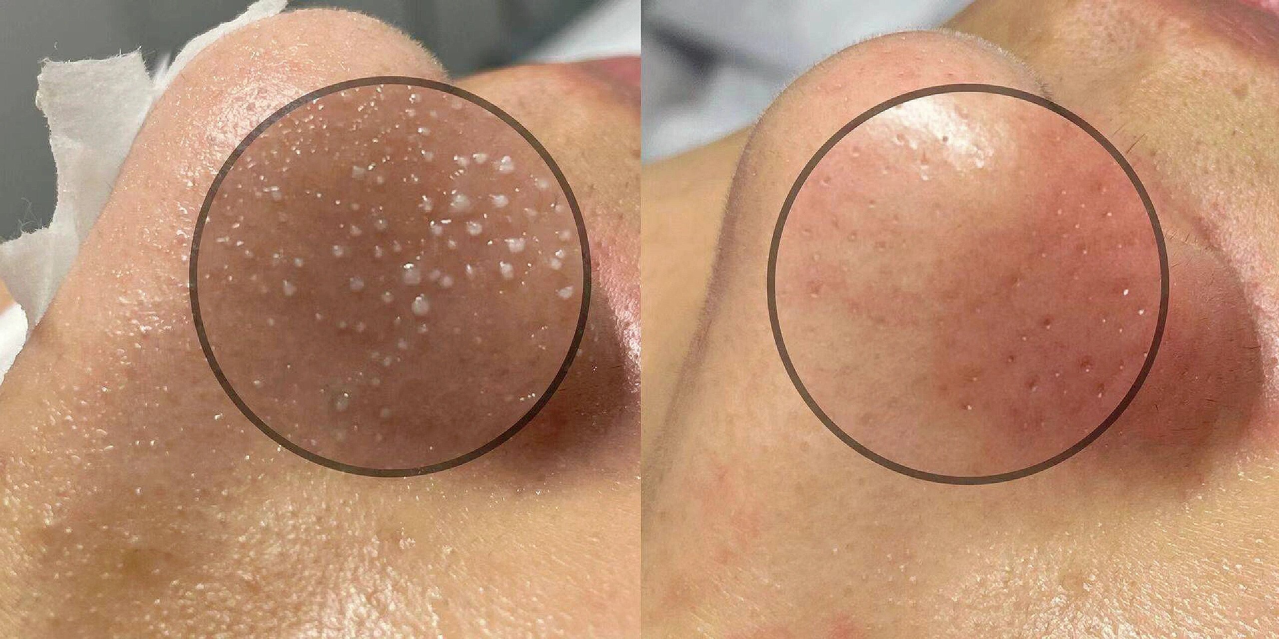 男士皮肤深层清洁 皮肤一键启动中 好看的