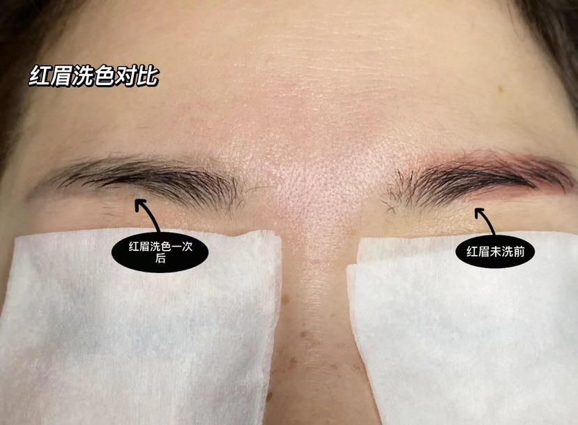 红眉案例洗色前后一次对比 很多人担心洗色