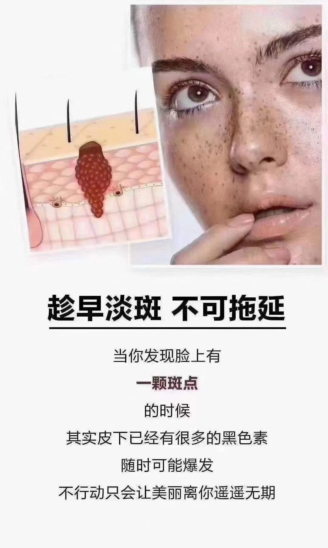 ✨✨✨ 一说到祛斑—— 哎呀怕伤到皮肤 