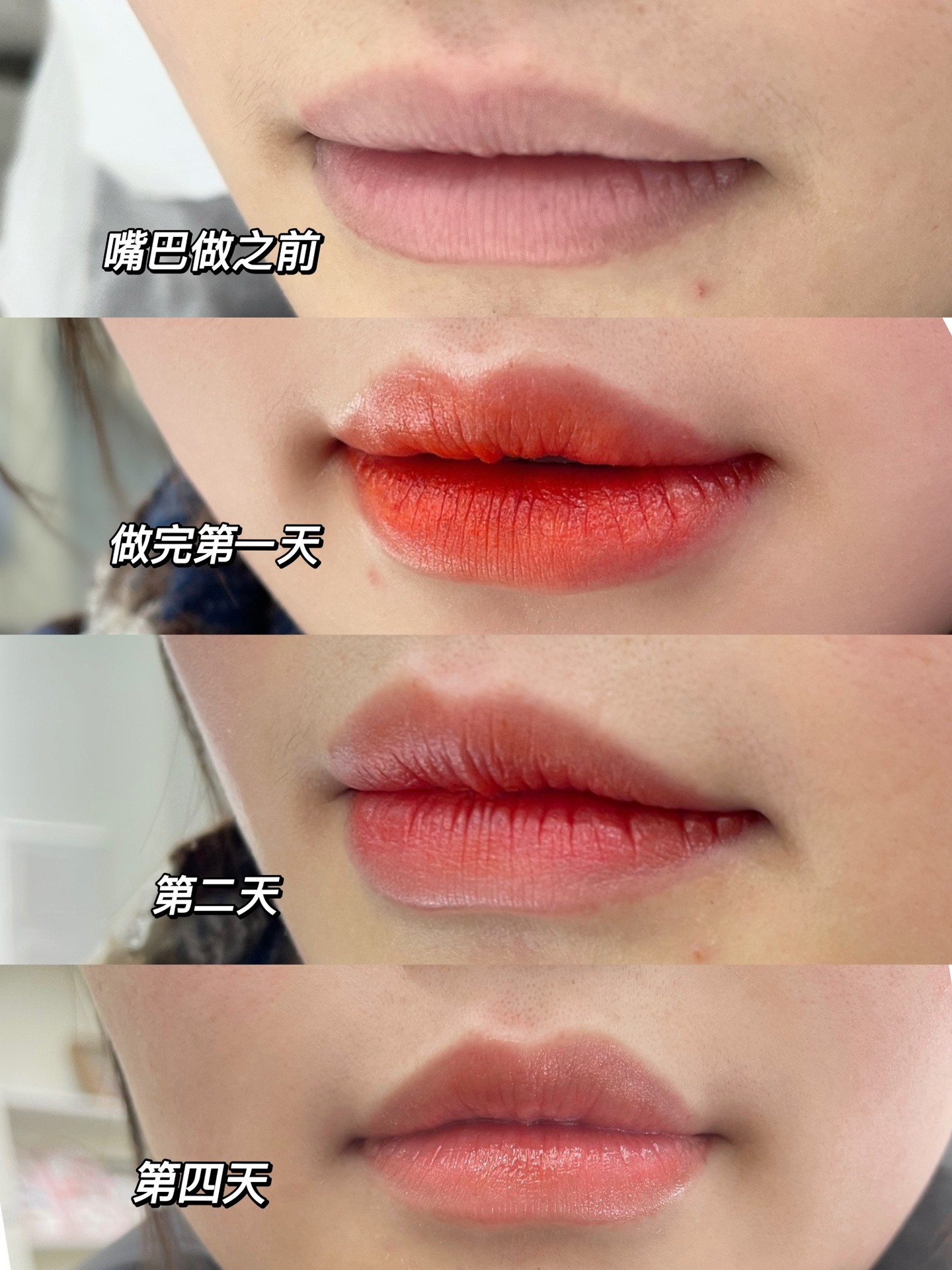 少女妈生唇👄 这样的唇色是你想拥有的吗 配图2