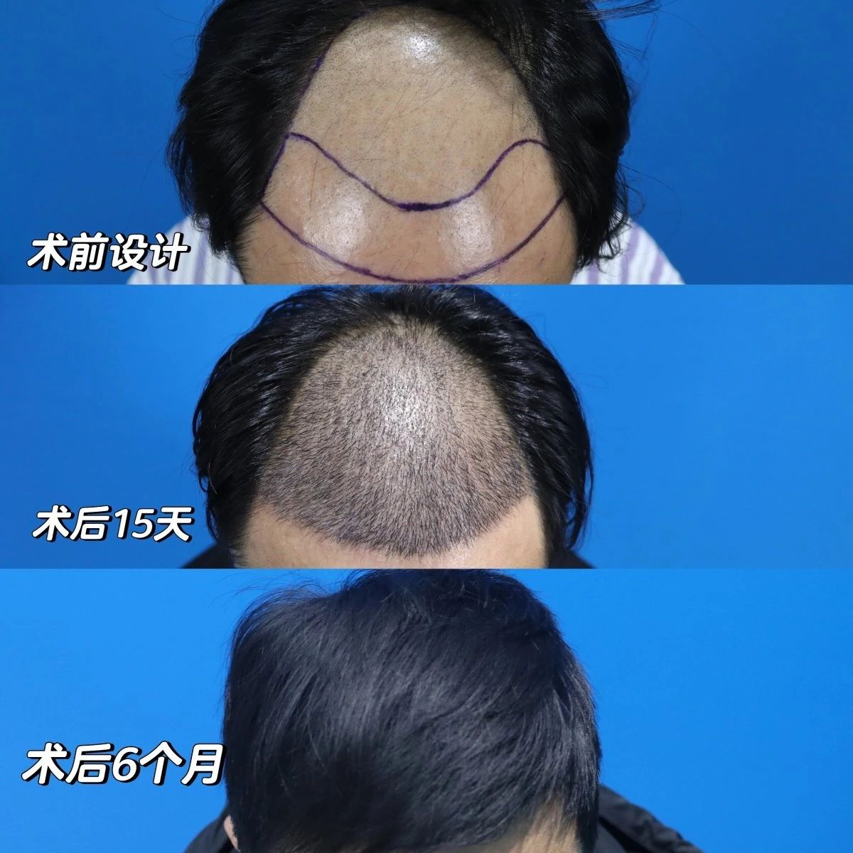 当你踏出这一步 改变的便不仅仅是头发 从