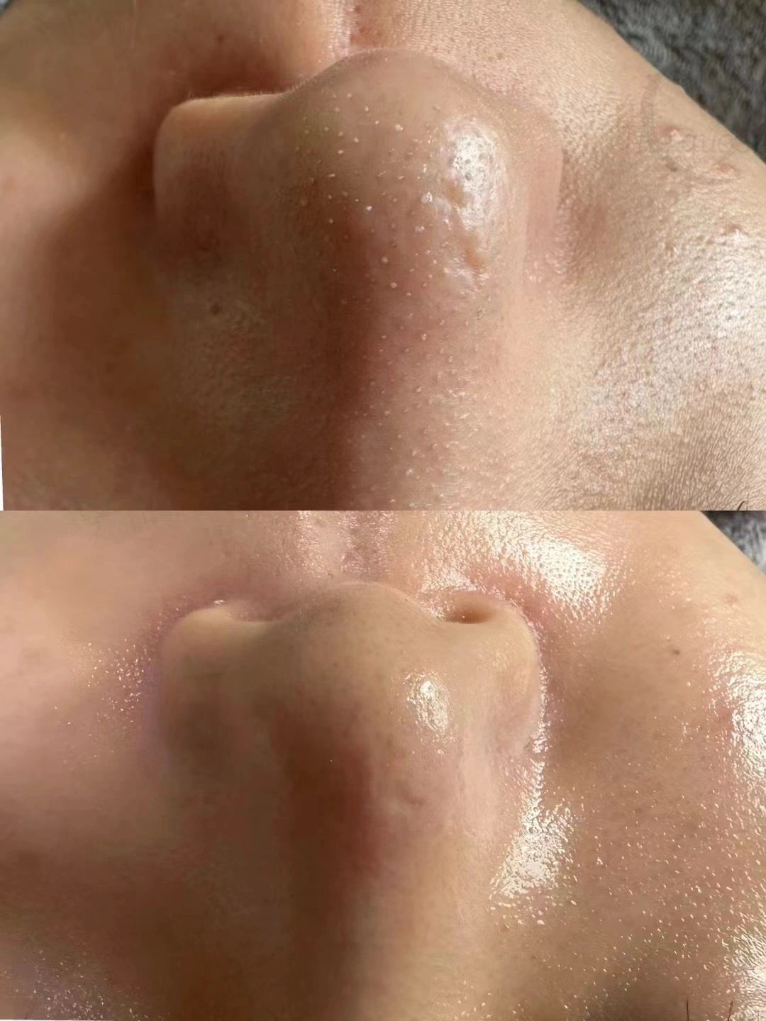 每周一次护理很有必要 如果最近肤色不均 