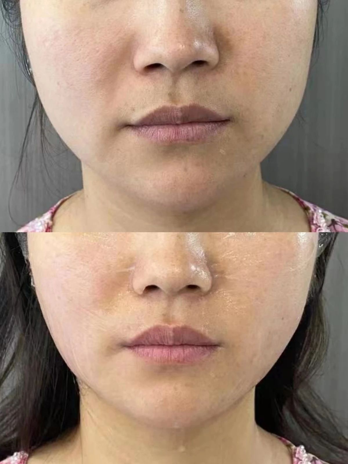 女生一旦过了25岁 皮肤状态明显不如从前