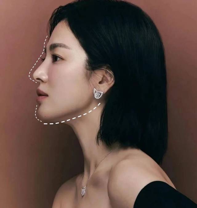 可以不整容但是一定要抗衰 因为每下垂1毫