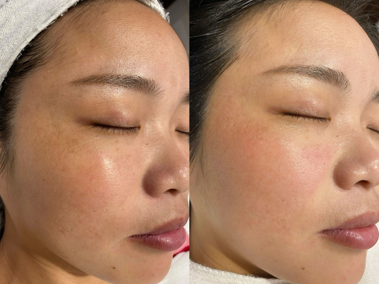 别让懒惰偷走你的美丽 有效的皮肤管理能事
