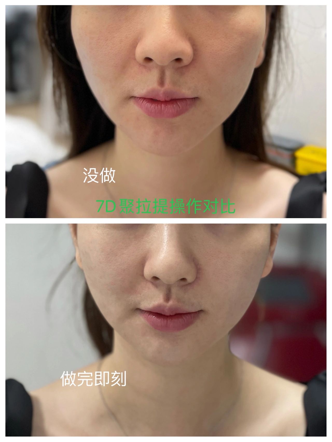 抗衰的意义 不是让你马上变仙女 而是5年 配图2