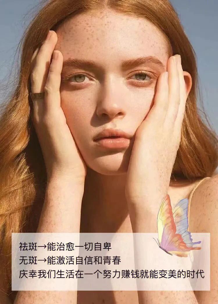祛斑能治愈一切自卑 无斑能激活自信和青春