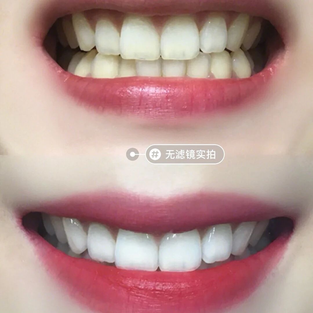 你的外表再精致 张嘴一口大黄牙 就是什么