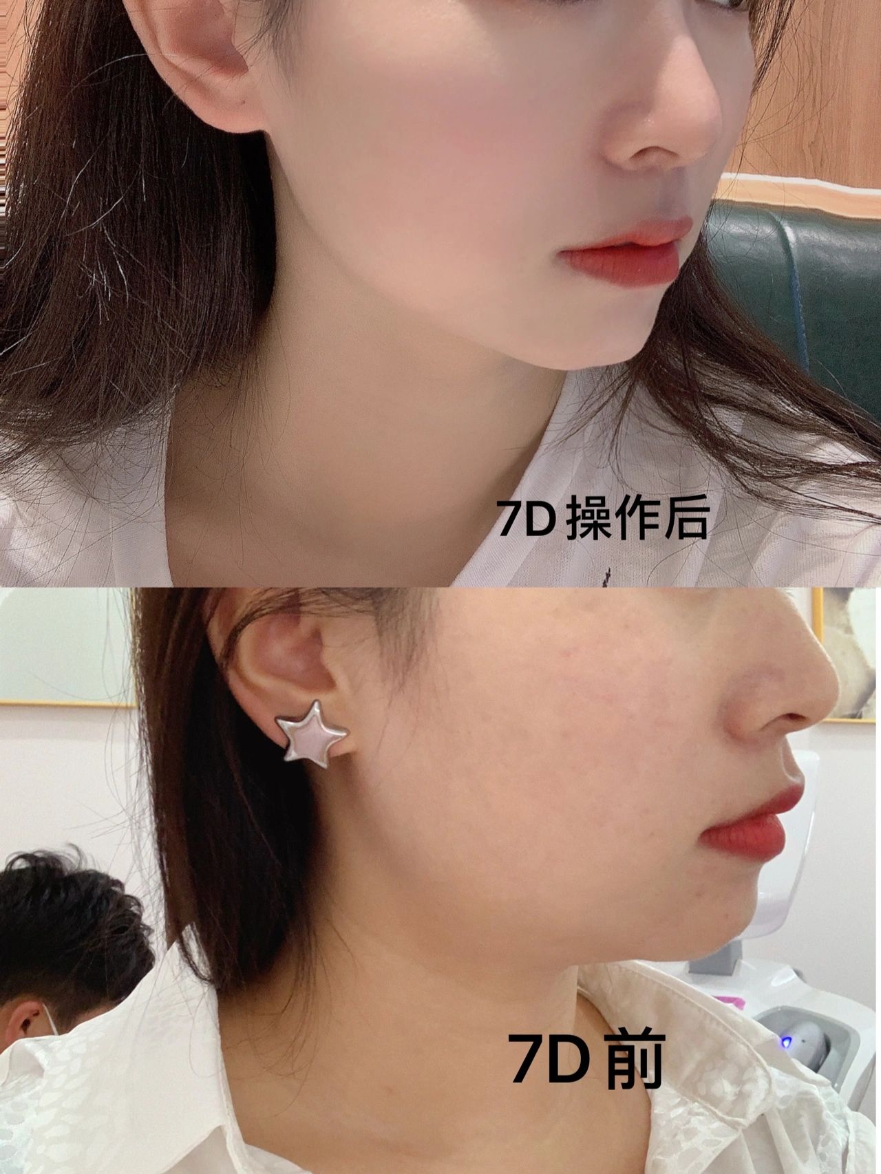 抗衰护肤的意义在于 [高级保养] 这个过