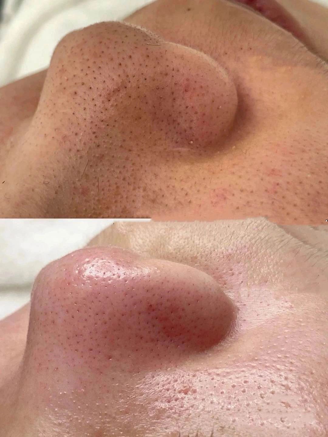 你的肌肤 是最贴近你的第一道防线 所以 