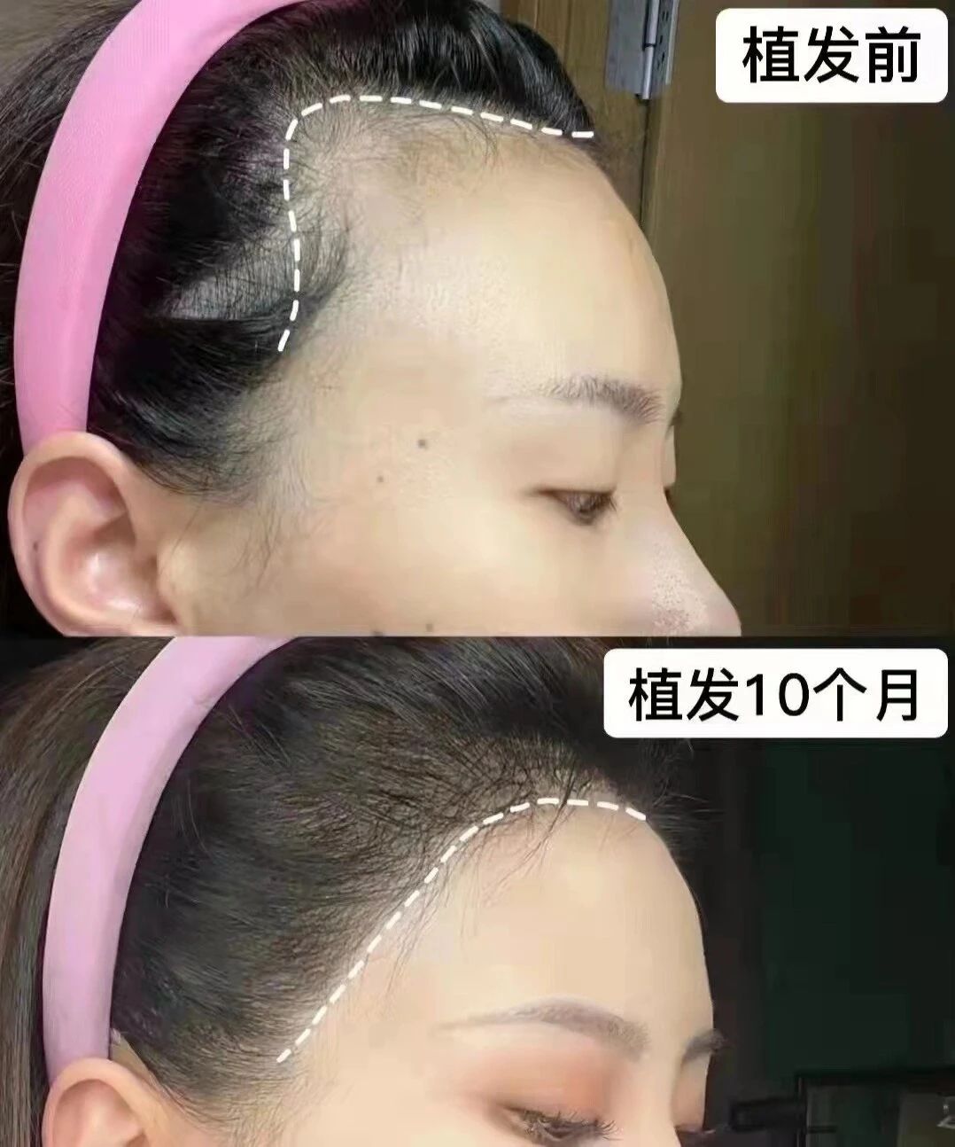 不能左右时光的逝去💫💫 那就甩掉稀疏的过