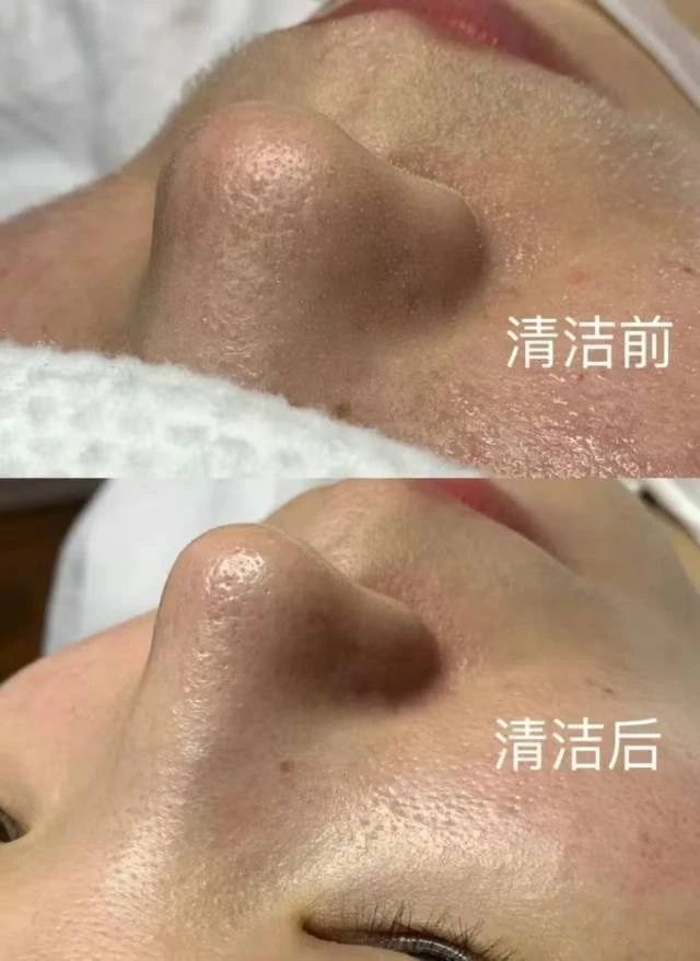 无论多忙，也要每周抽出时间做一次皮肤管理