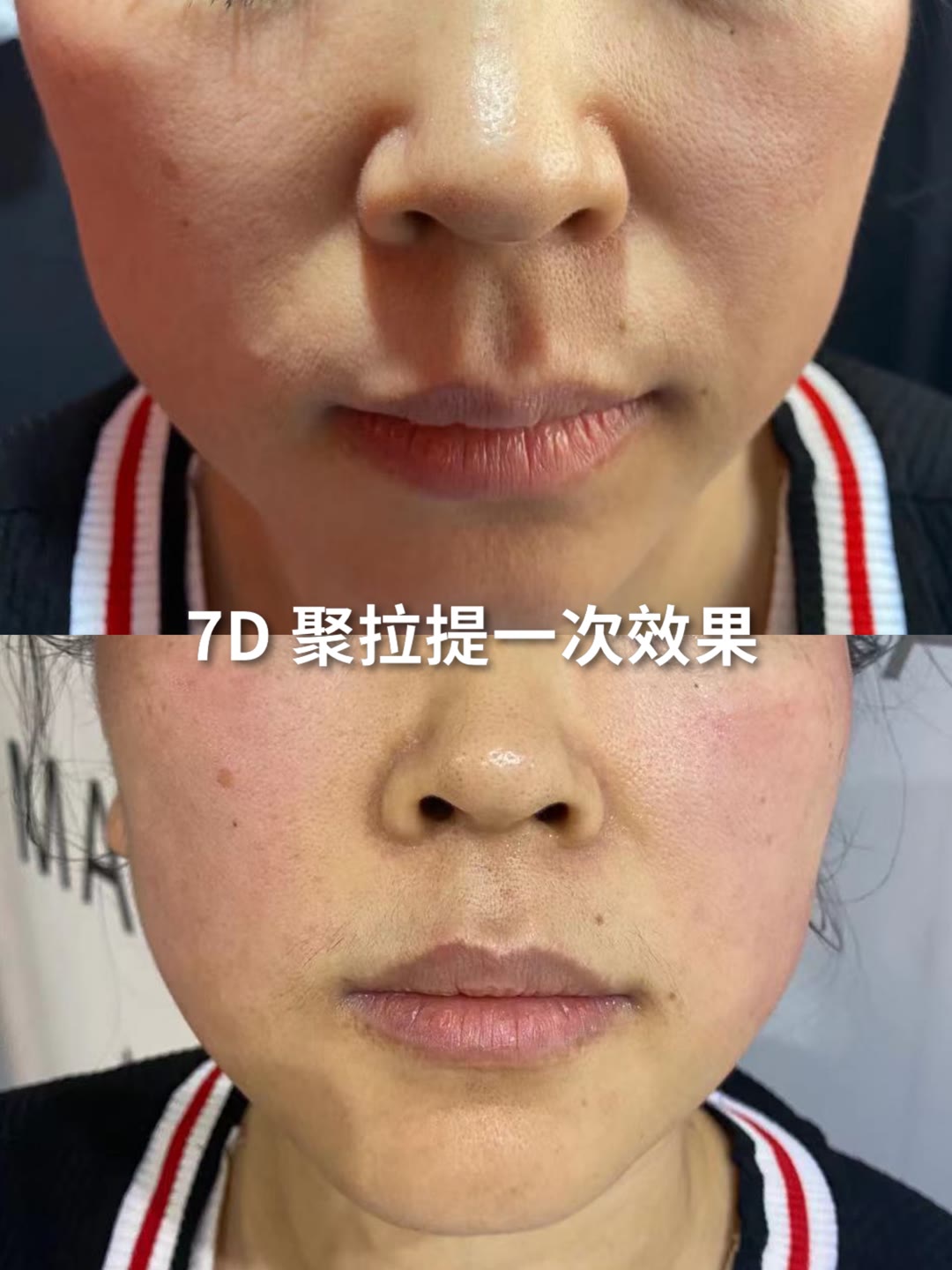 别把抗衰的顺序搞反了 不是有了效果才坚持