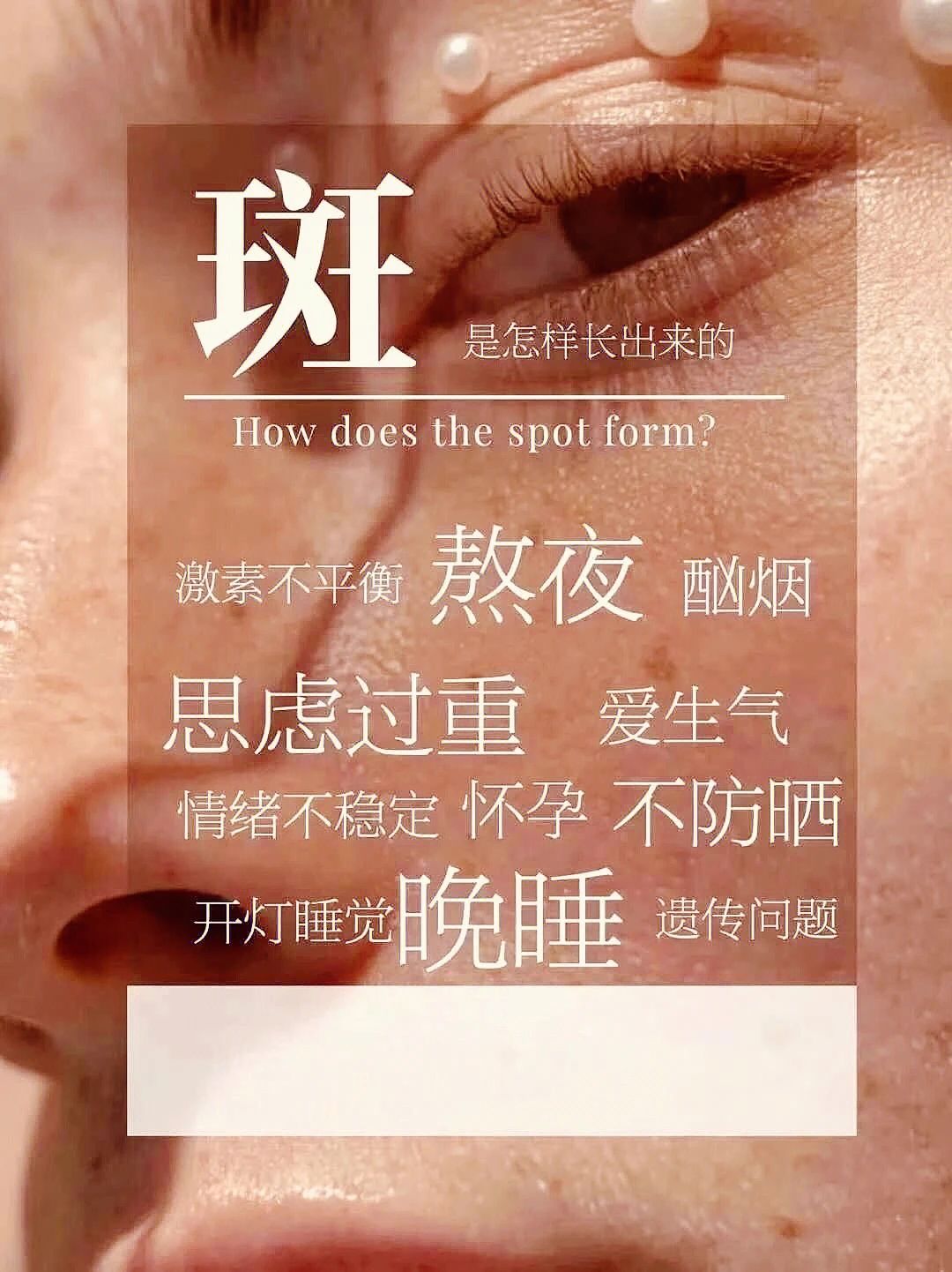 真正的祛斑都是要代谢的！ 黑色素和垃圾不