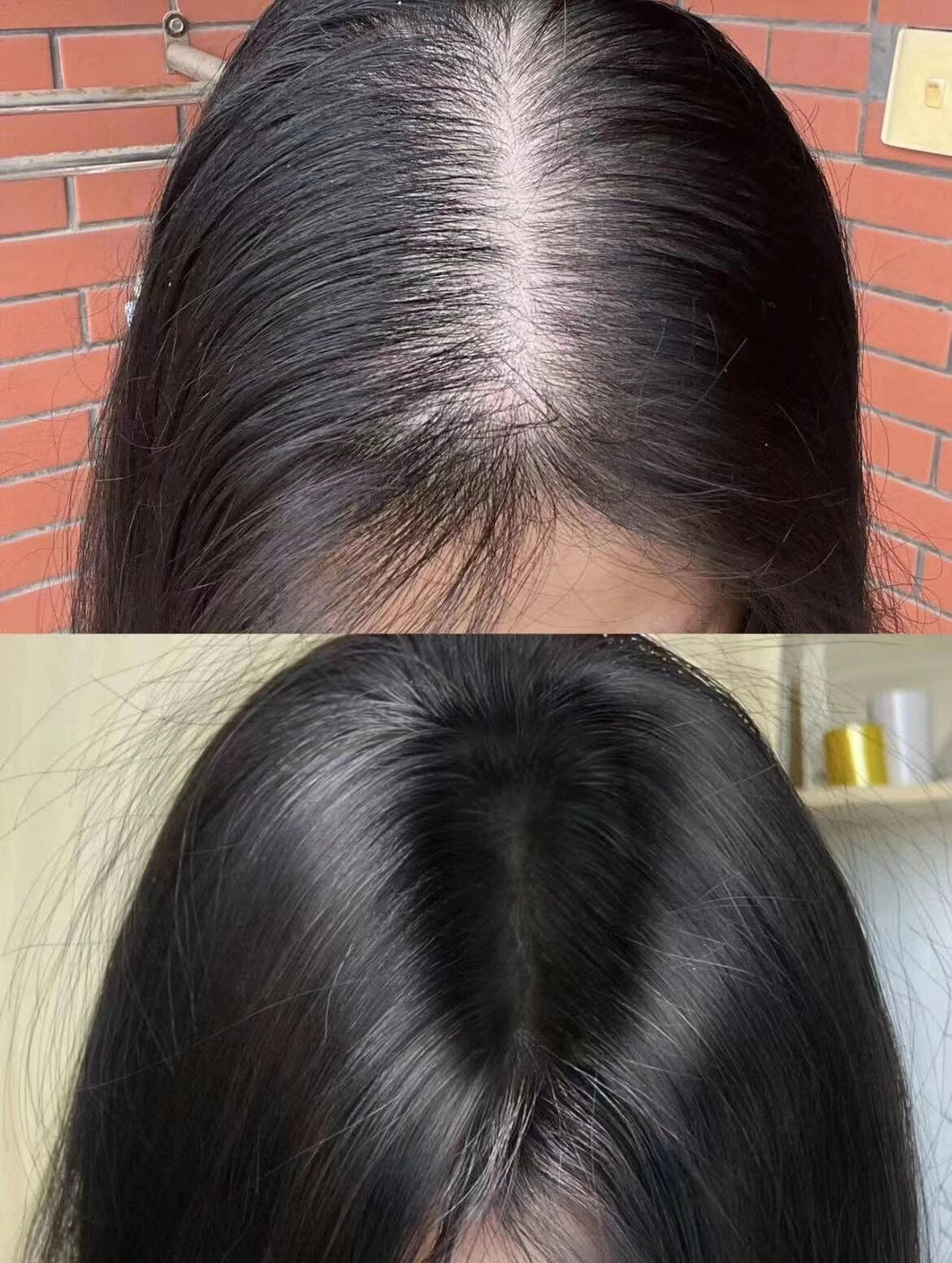 ✅头皮护理 缺少水分和营养容易造成 头皮