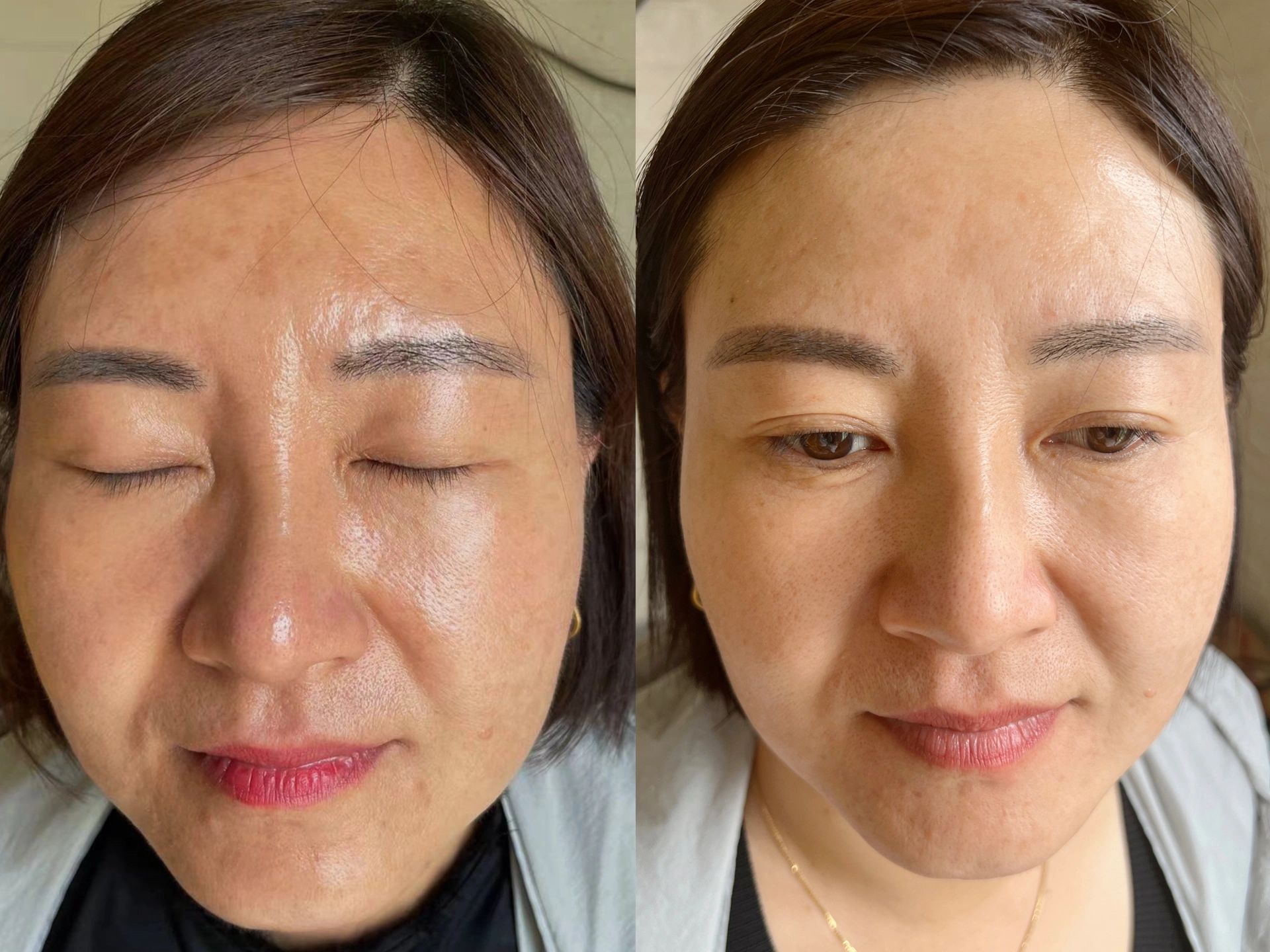 祛斑的时间只是一阵子 漂亮的时间却是一辈 配图2