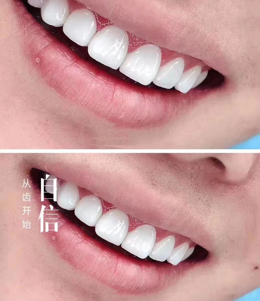远看腿，近看嘴 美牙帮你告别容貌焦虑 笑
