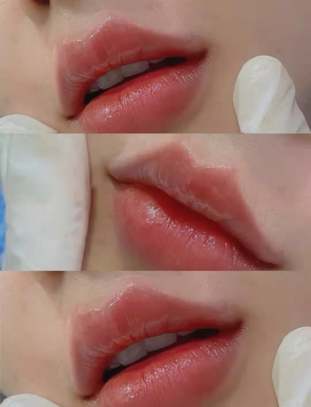仙女的嘴唇折角 为什么打嘴唇一定要加深唇