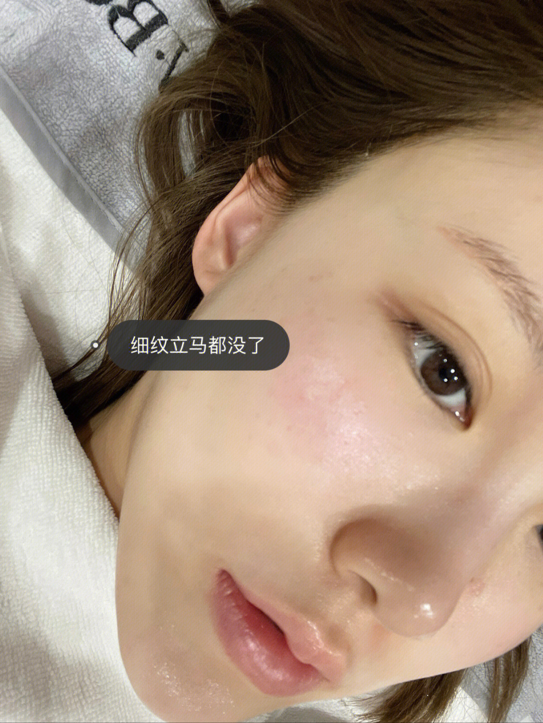 卡戴珊同款BTL胶原枪 20多岁的女生  配图2
