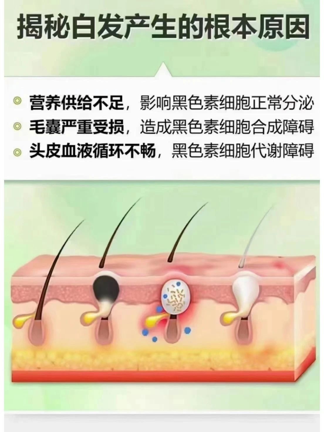 💢白发产生的根本原因你知道吗❓ 1、营养