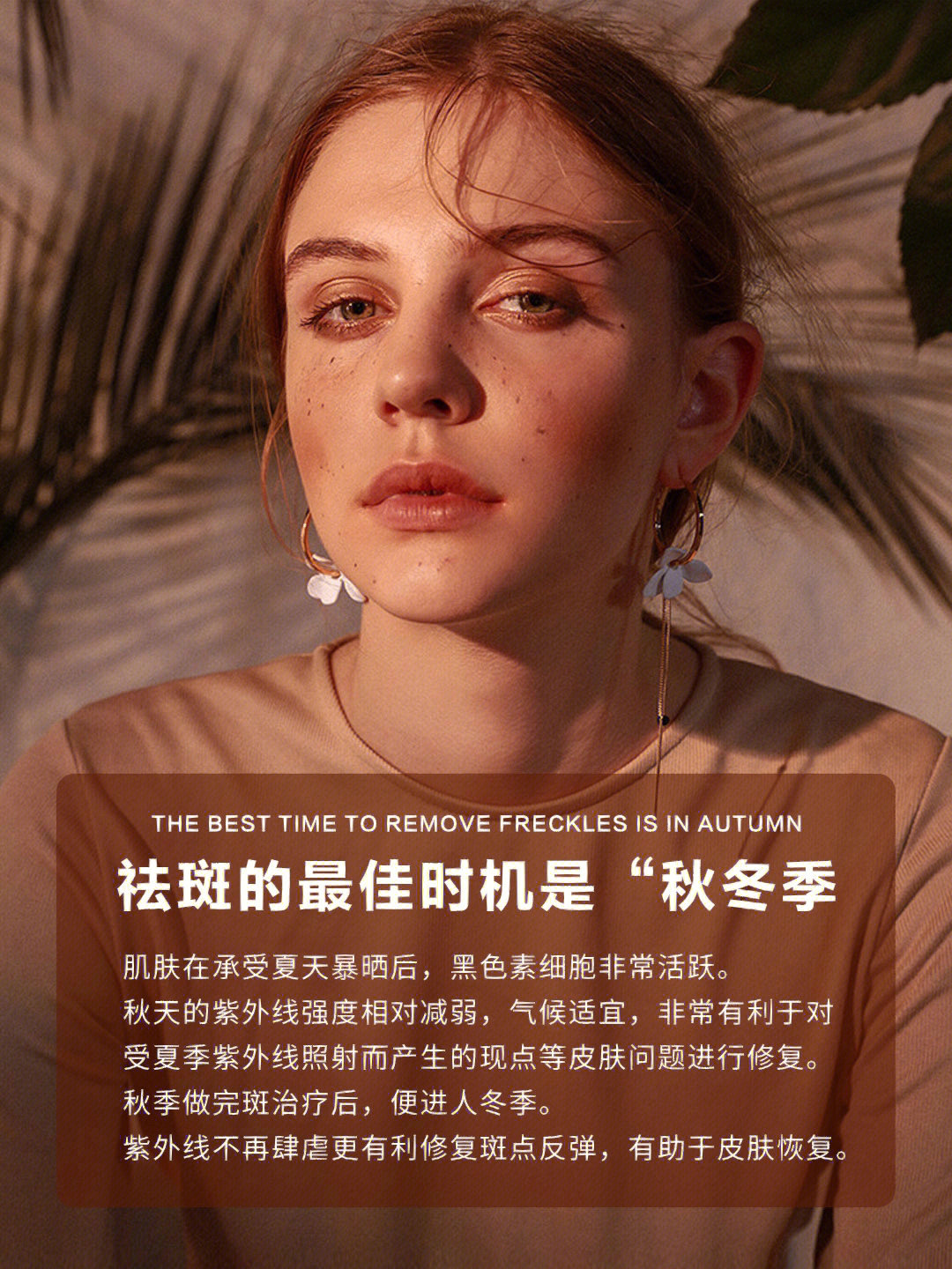祛斑的最佳时机是“秋冬季 肌肤在承受夏天