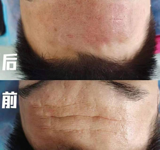 生活的每一道皱纹， 都是笑声与泪水的交汇