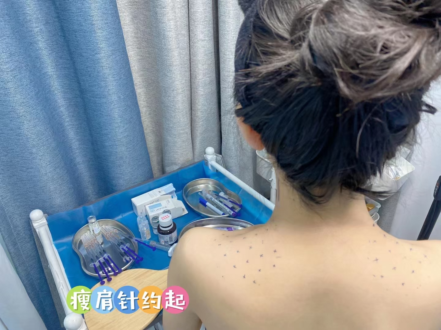 瘦肩针 约起