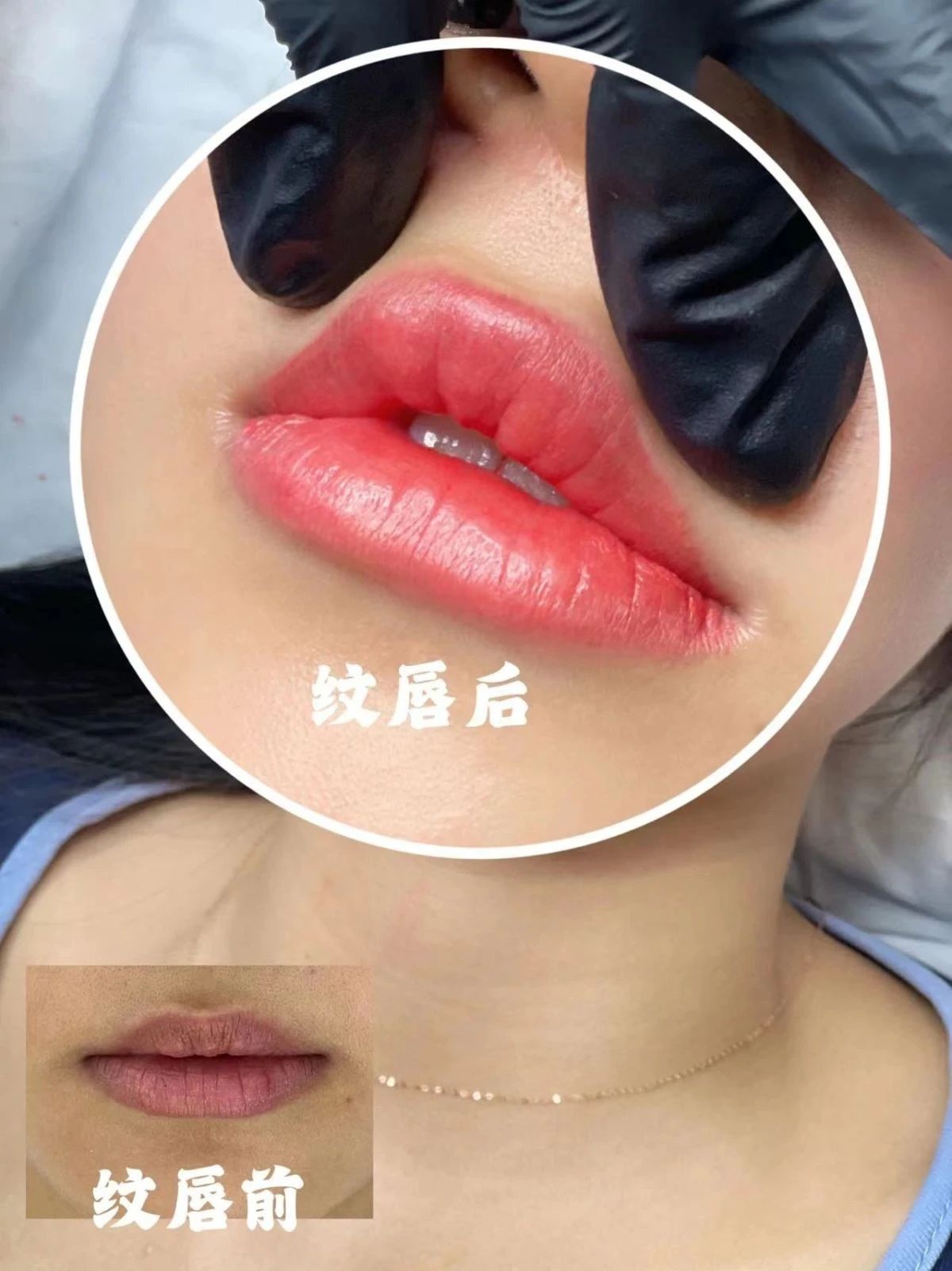 纹唇即刻效果，尊嘟很爱 拒绝浅唇带来的“