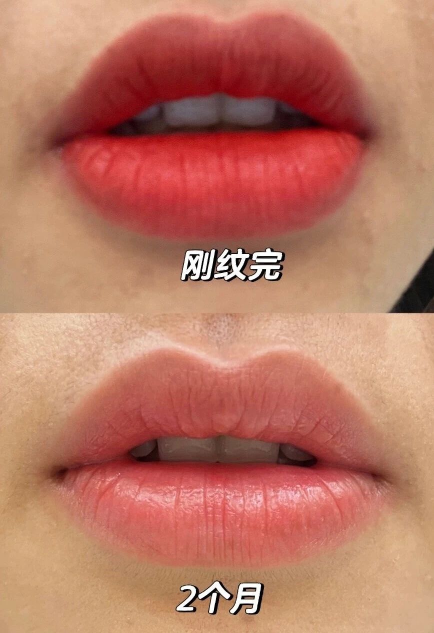 唇部两个月反馈 你敢相信是没涂口红的效果
