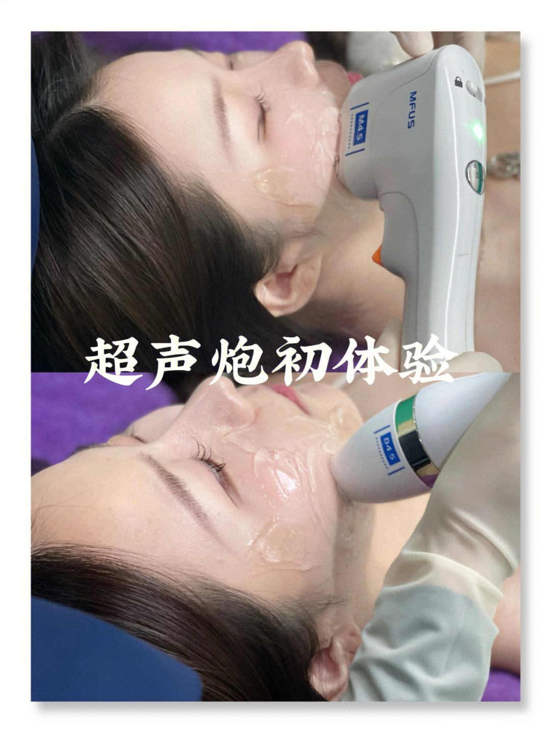做仪器最大的目的是延缓它衰老的速度 而不 配图3