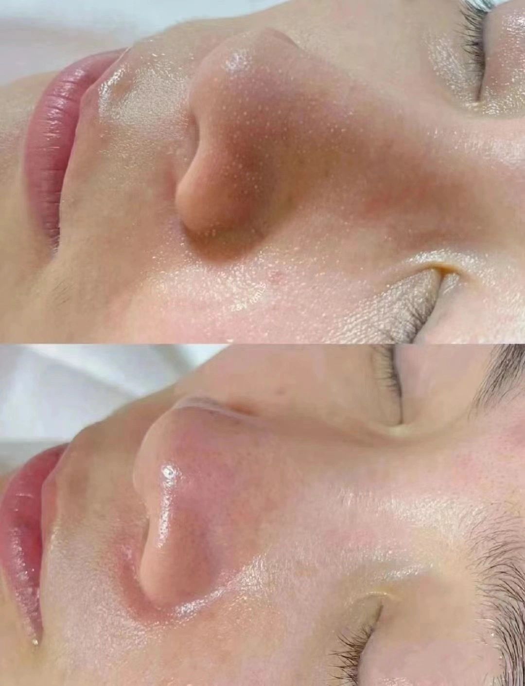 毛孔清洁前后对比VS 其实是你的皮肤在提