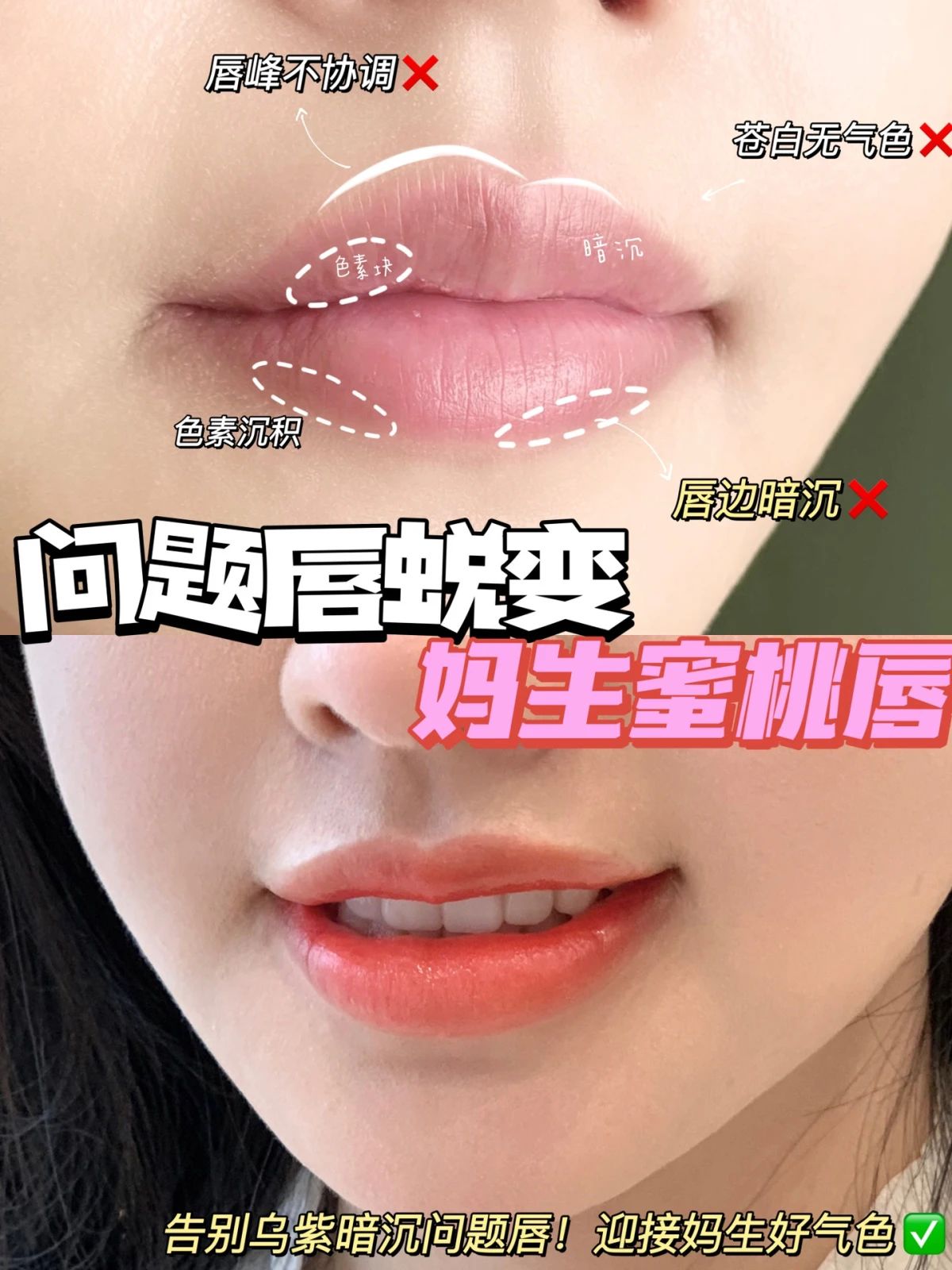 纹唇原来真的可以微调 告别乌紫暗沉问题唇