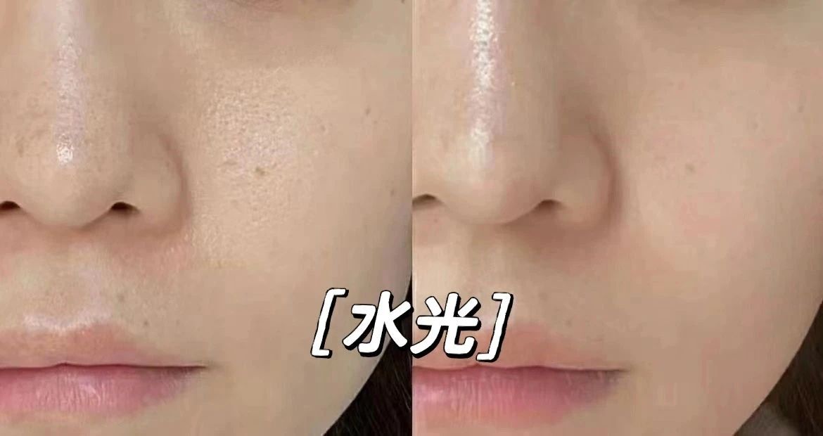 秋天第一支水光针 你安排了吗？ 对待皮肤
