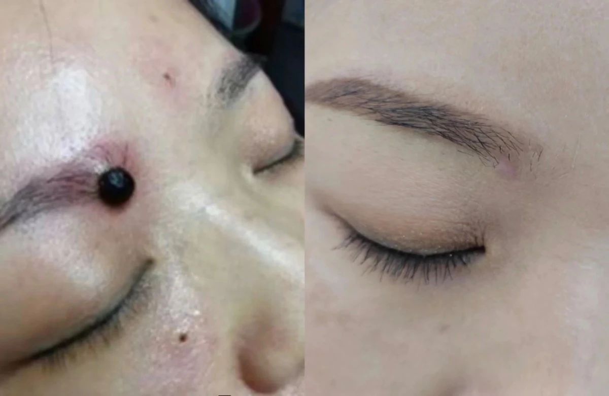 眉毛中若有痣，且能遮住，务必保留 象征着
