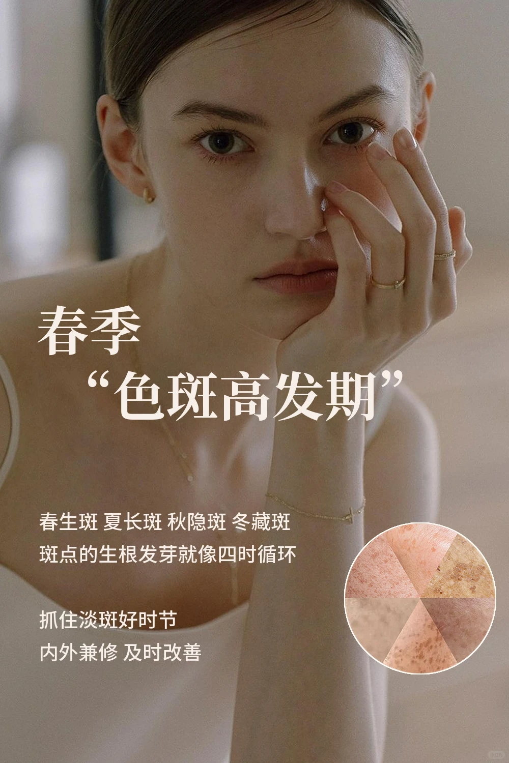 春季“色斑高发期” 春生斑 夏长斑 秋隐
