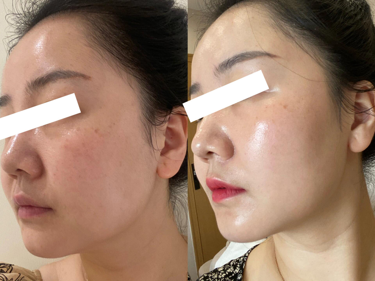 水光护理 让肌肤喝饱水的感觉 让你的容颜