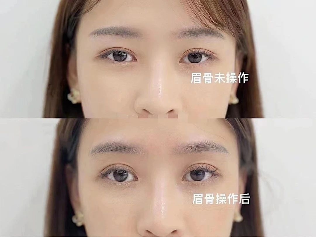 眼神支撑的力量 其实眉形也很重要的 很多
