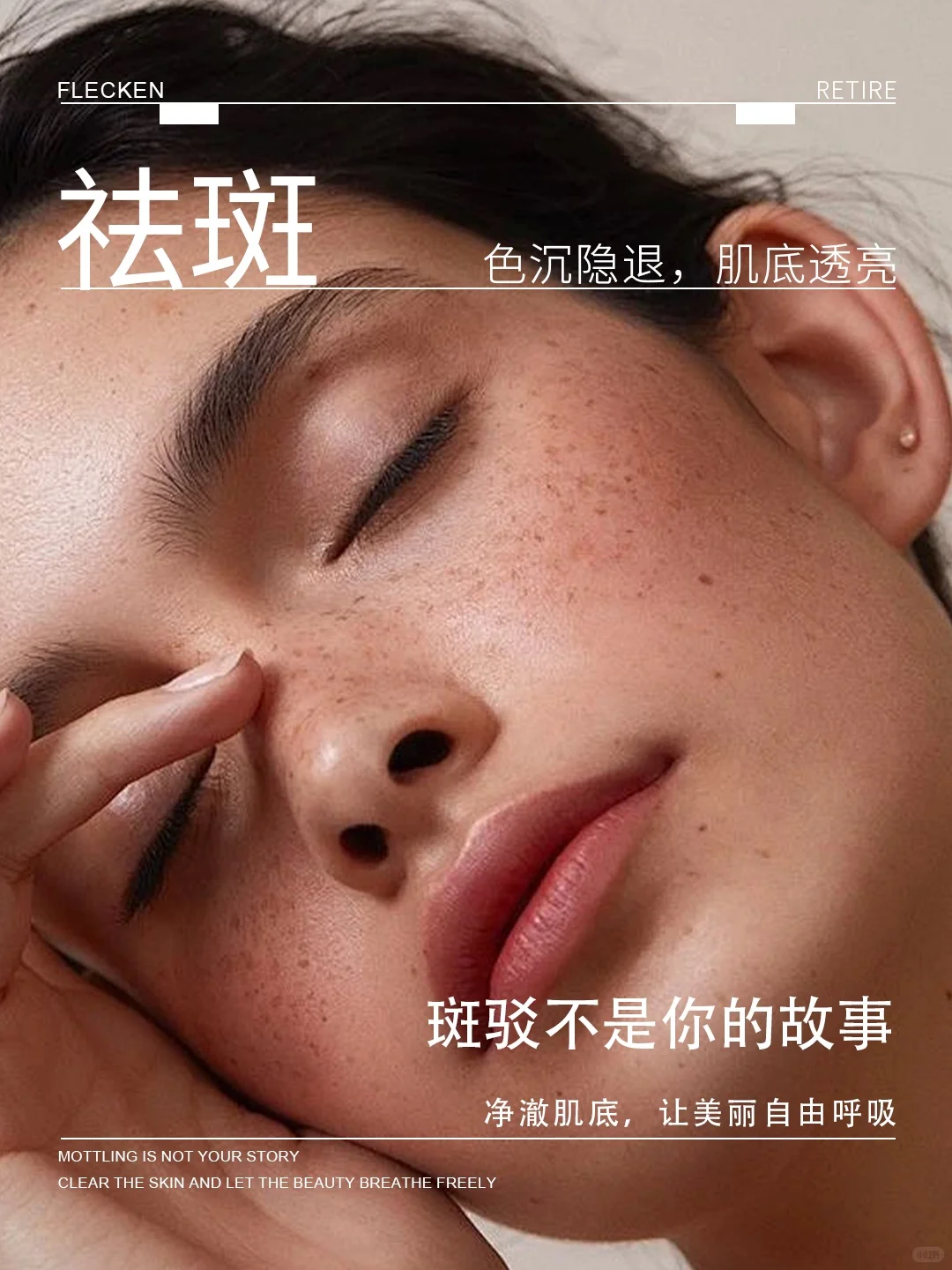 斑驳不是你的故事 净澈肌底，让美丽自由呼