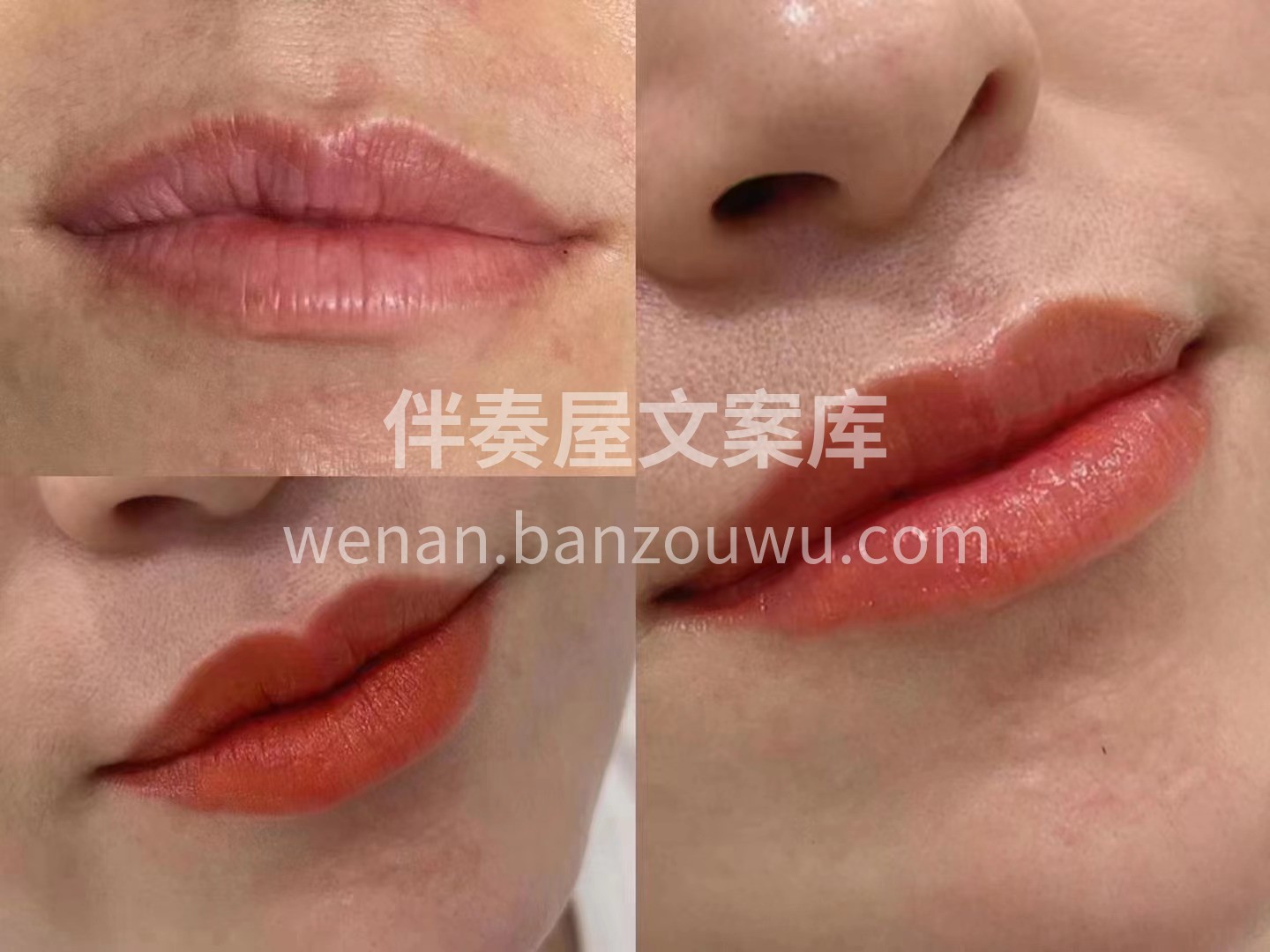 一定要把唇做了💋 无痛恢复快恢复后呈自然