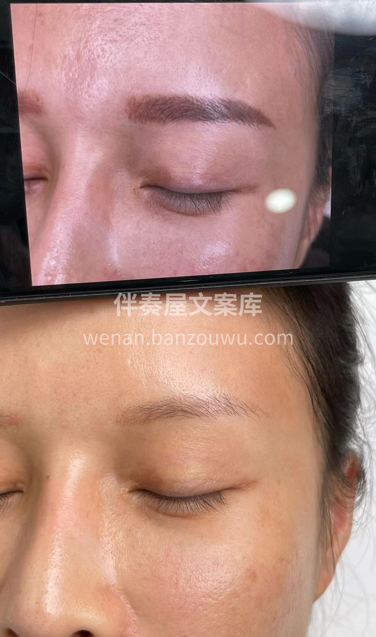 洗眉合集案例 配图4