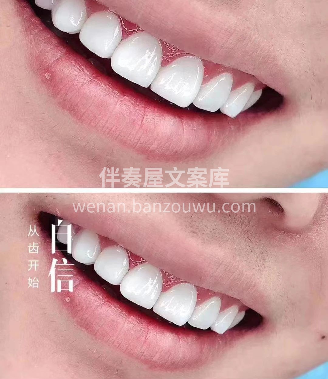 远看腿，近看嘴 美牙帮你告别容貌焦虑 笑
